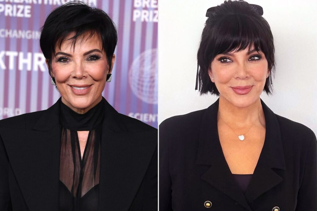 Η Kris Jenner δεν έχει επιβεβαιώσει τις συγκεκριμένες επεμβάσεις που έχει υποβληθεί